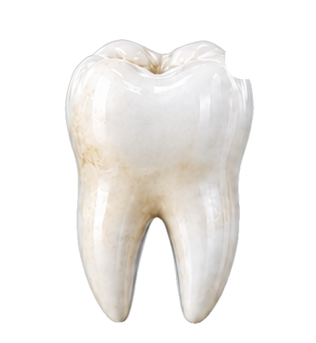 Tooth with stains lifting